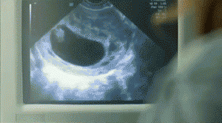 老外帶妻子產檢照B超搞笑gif：比利時色醫生和老婆當面干？頂到子宮了
