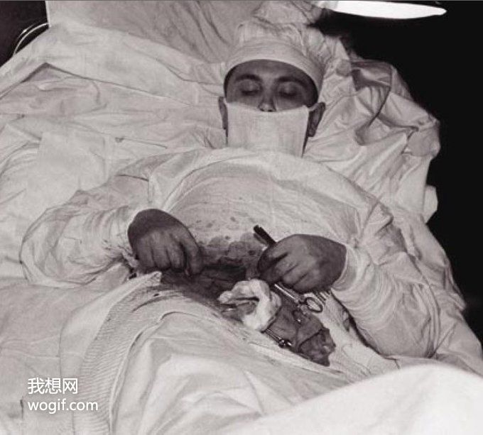 俄羅斯醫(yī)生，給自己做手術(shù)切除了闌尾（有圖）