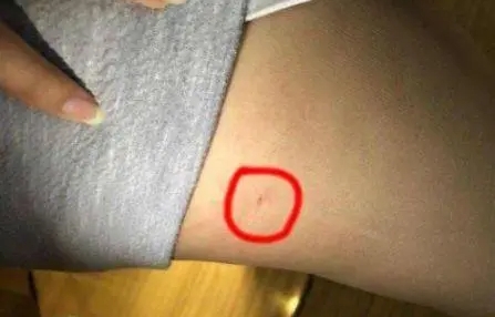 針扎到女朋友了，我要糙你，快點塞進來，我就早塞進去了好痛...
